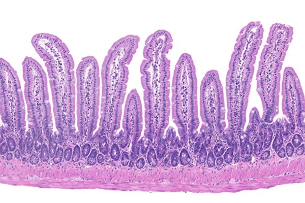Researchers find intestinal immune cell prevents food allergies